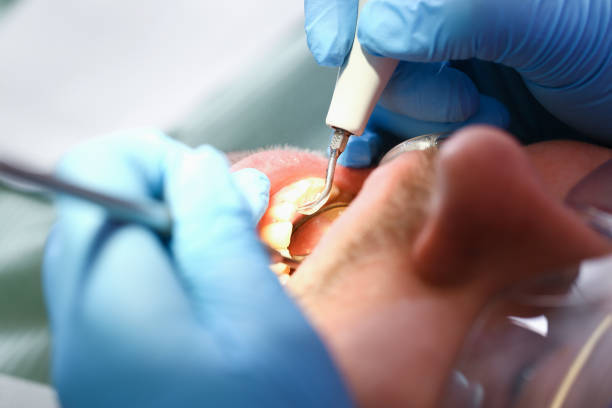Best Emergency Dental Care for Sports Injuries in Byram, MS
