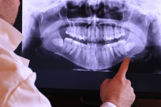 Best Dental Abscess Treatment in Byram, MS