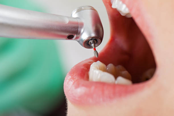 Best Emergency Treatment for Oral Infections in Byram, MS